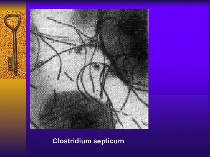 Clostridium septicum