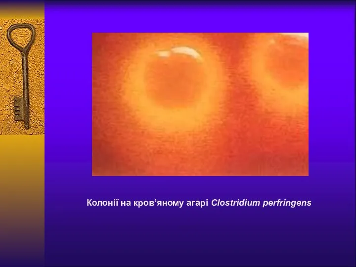 Колонії на кров’яному агарі Clostridium perfringens