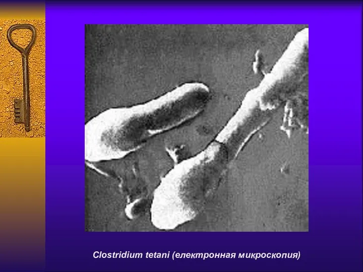 Clostridium tetani (електронная микроскопия)