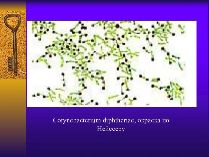 Corynebacterium diphtheriae, окраска по Нейссеру