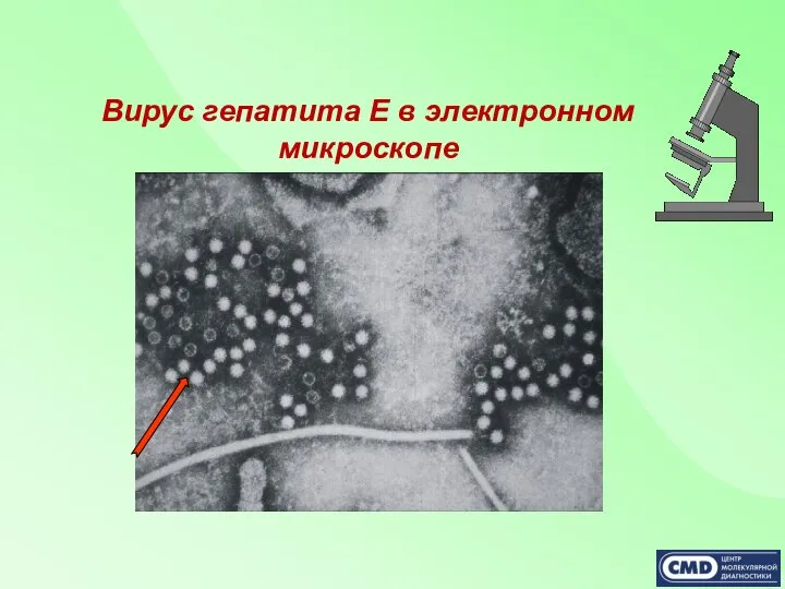 Вирус гепатита Е в электронном микроскопе