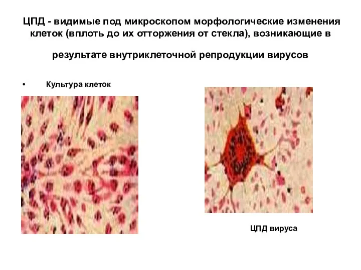 ЦПД - видимые под микроскопом морфологические изменения клеток (вплоть до их