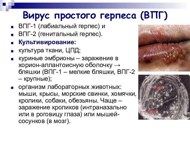 Вирус простого герпеса (ВПГ) ВПГ-1 (лабиальный герпес) и ВПГ-2 (генитальный герпес).