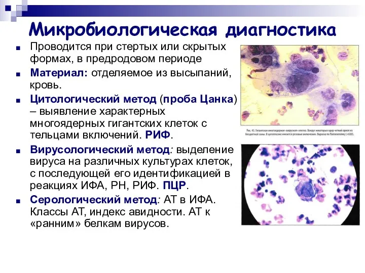 Микробиологическая диагностика Проводится при стертых или скрытых формах, в предродовом периоде