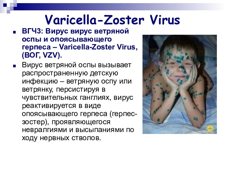 Varicella-Zoster Virus ВГЧ3: Вирус вирус ветряной оспы и опоясывающего герпеса –