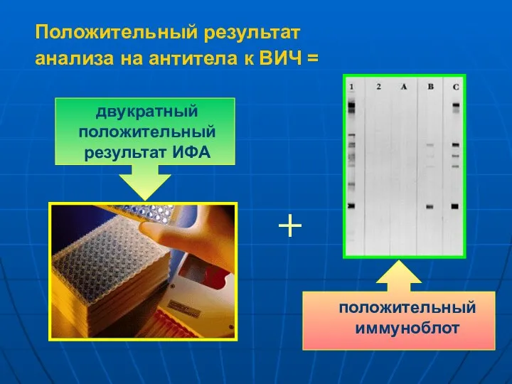 Положительный результат анализа на антитела к ВИЧ = двукратный положительный результат ИФА + положительный иммуноблот