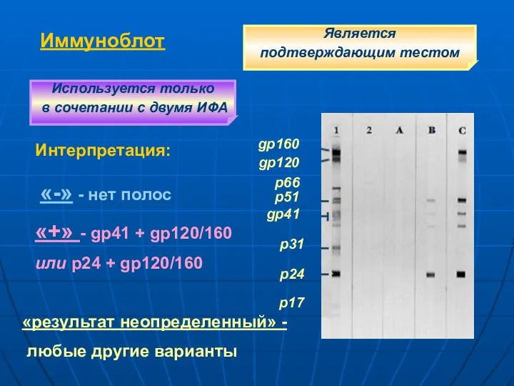 Иммуноблот gp160 gp120 p51 gp41 p31 p24 Интерпретация: «-» - нет