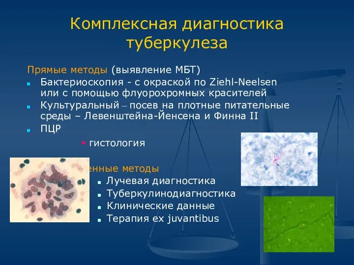 Комплексная диагностика туберкулеза Прямые методы (выявление МБТ) Бактериоскопия - с окраской