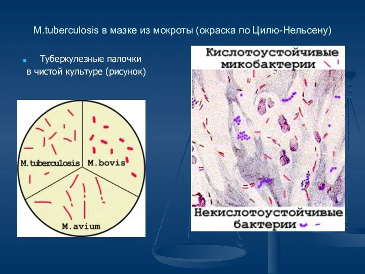 M.tuberculosis в мазке из мокроты (окраска по Цилю-Нельсену) Туберкулезные палочки в чистой культуре (рисунок)