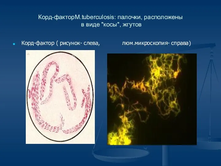 Корд-факторM.tuberculosis: палочки, расположены в виде "косы", жгутов Корд-фактор ( рисунок- слева, люм.микроскопия- справа)