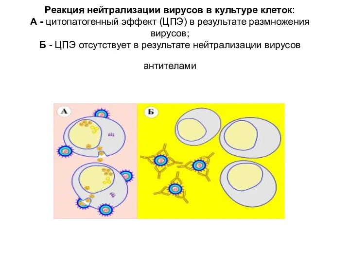 Реакция нейтрализации вирусов в культуре клеток: А - цитопатогенный эффект (ЦПЭ)