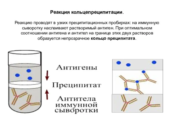 Реакция кольцепреципитации. Реакцию проводят в узких преципитационных пробирках: на иммунную сыворотку