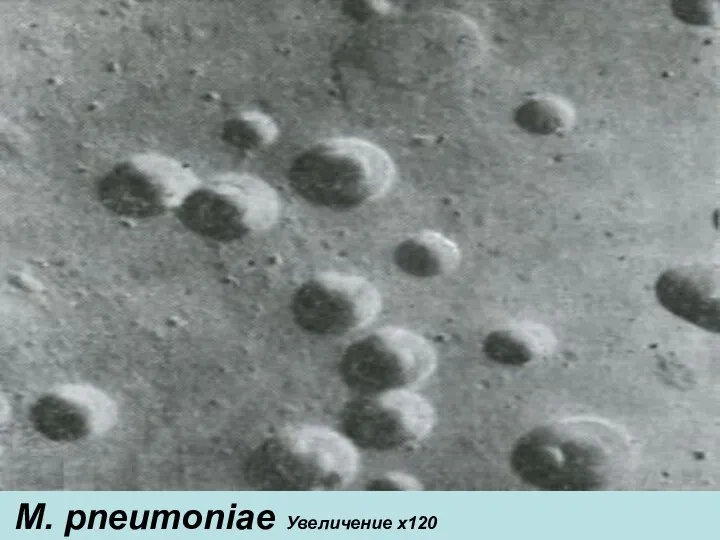 M. pneumoniae Увеличение х120