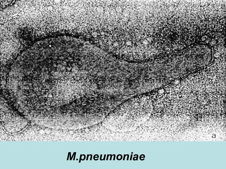 M.pneumoniae M.pneumoniae