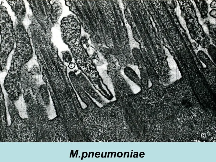 M.pneumoniae