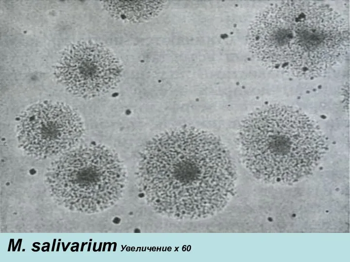 M. salivarium Увеличение х 60 M. salivarium Увеличение х 60