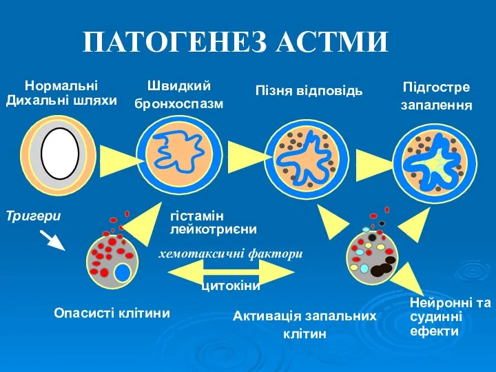 ПАТОГЕНЕЗ АСТМИ Швидкий бронхоспазм Пізня відповідь Підгостре запалення Нормальні Дихальні шляхи