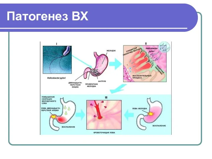 Патогенез ВХ