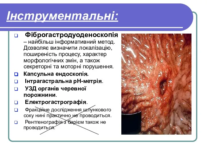 Інструментальні: Фіброгастродуоденоскопія – найбільш інформативний метод. Дозволяє визначити локалізацію, поширеність процесу,