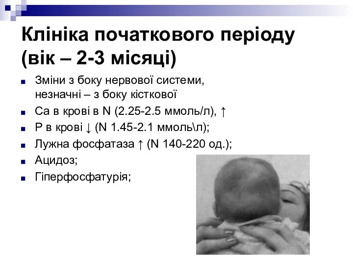 Клініка початкового періоду (вік – 2-3 місяці) Зміни з боку нервової