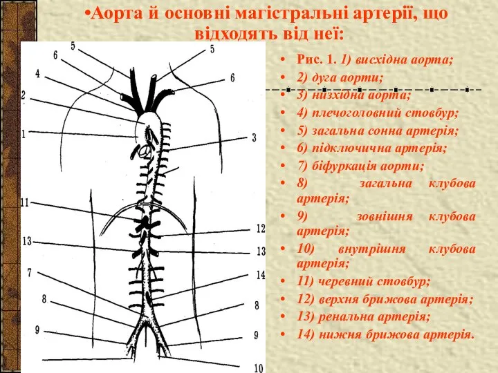 Рис. 1. 1) висхідна аорта; 2) дуга аорти; 3) низхідна аорта;