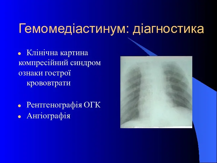 Гемомедіастинум: діагностика Клінічна картина компресійний синдром ознаки гострої крововтрати Рентгенографія ОГК Ангіографія