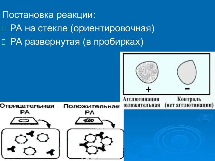 Постановка реакции: РА на стекле (ориентировочная) РА развернутая (в пробирках)