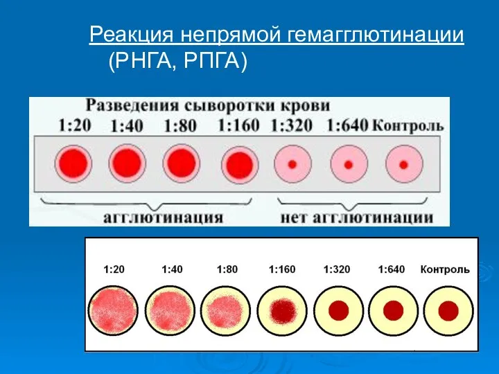 Реакция непрямой гемагглютинации (РНГА, РПГА)