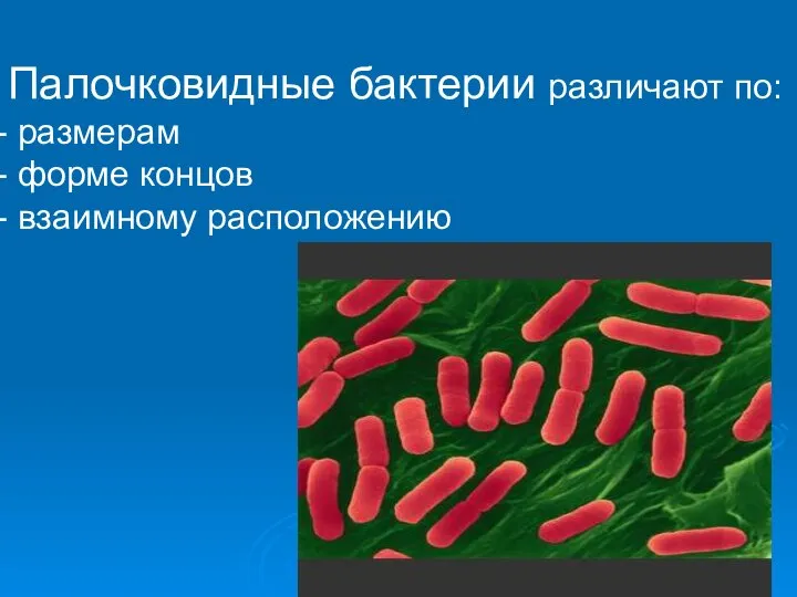 Палочковидные бактерии различают по: размерам форме концов взаимному расположению