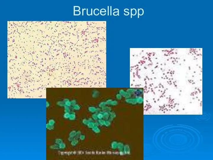 Brucella spp