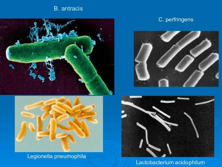 B. antracis Lactobacterium acidophilum Legionella pneumophila C. perfringens