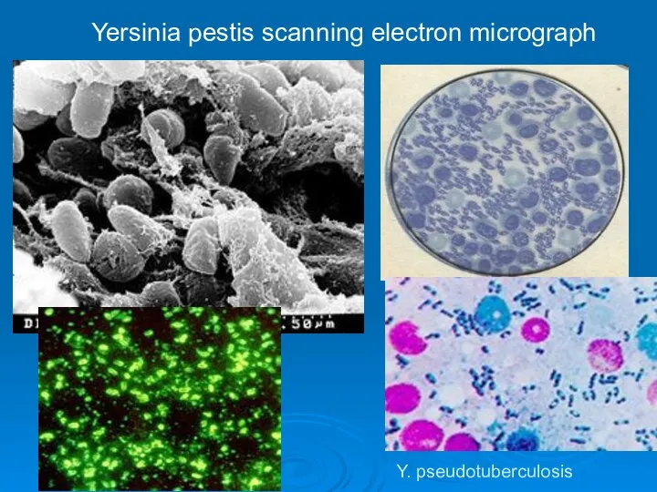 Yersinia pestis scanning electron micrograph Y. pseudotuberculosis