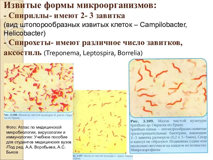 Извитые формы микроорганизмов: - Спириллы- имеют 2- 3 завитка (вид штопорообразных