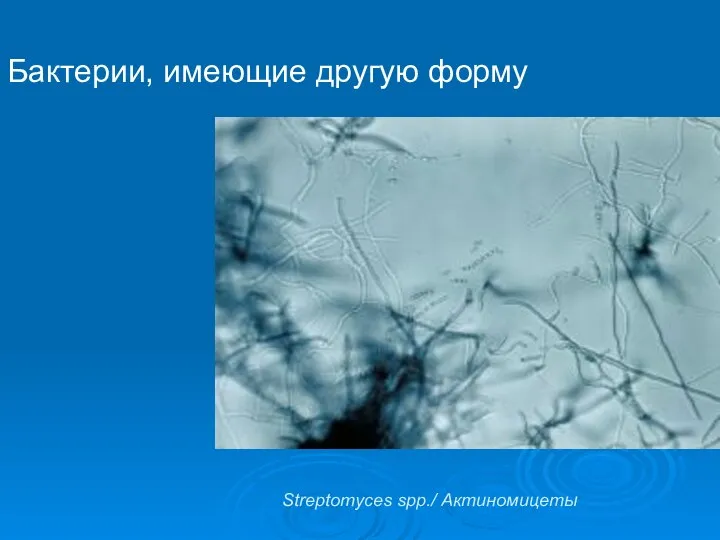 Бактерии, имеющие другую форму Streptomyces spp./ Актиномицеты