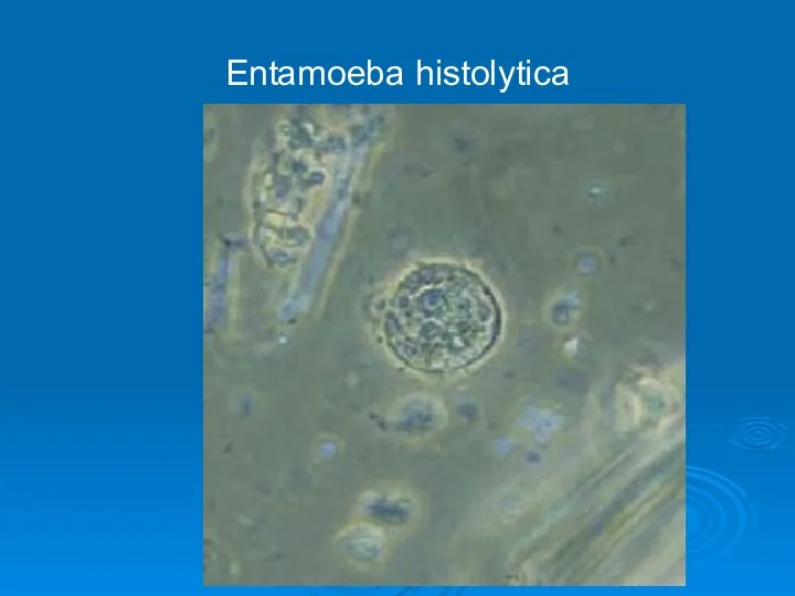 Entamoeba histolytica