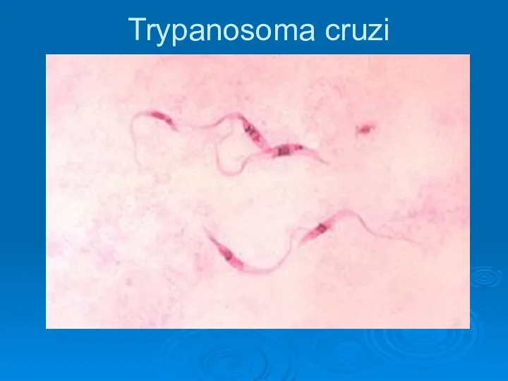 Trypanosoma cruzi