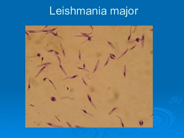 Leishmania major