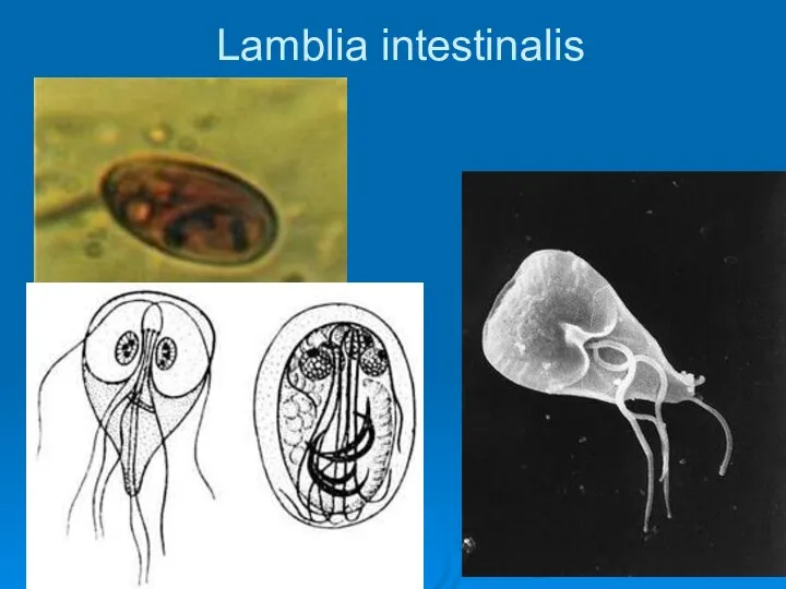 Lamblia intestinalis