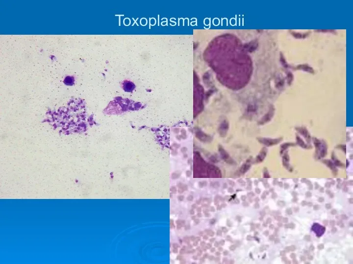 Toxoplasma gondii