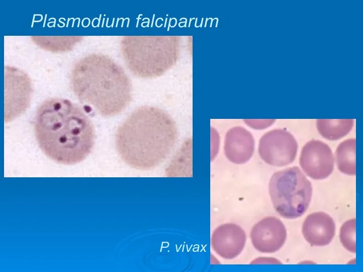 Plasmodium falciparum P. vivax