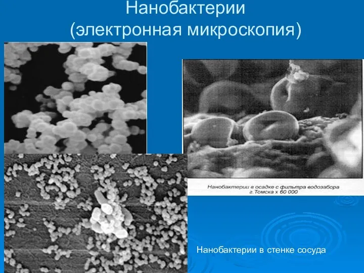 Нанобактерии (электронная микроскопия) Нанобактерии в стенке сосуда