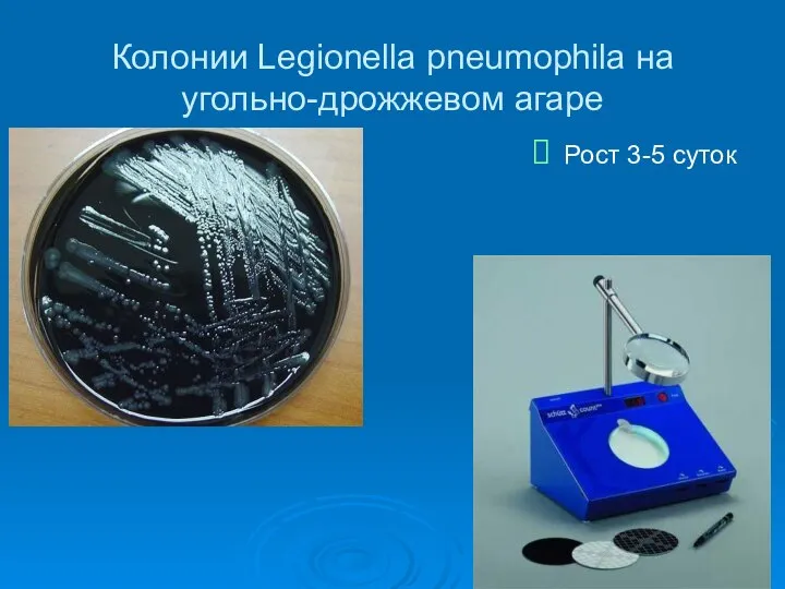 Колонии Legionella pneumophila на угольно-дрожжевом агаре Рост 3-5 суток