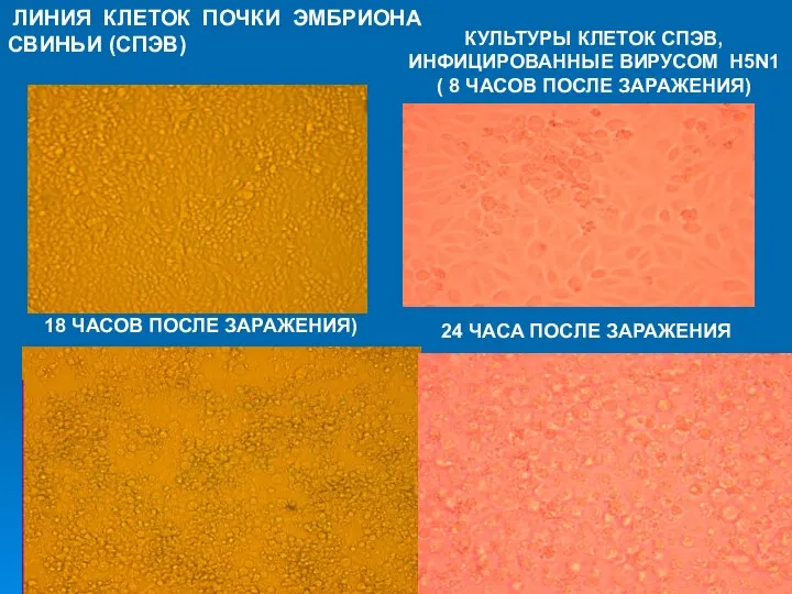 ЛИНИЯ КЛЕТОК ПОЧКИ ЭМБРИОНА СВИНЬИ (СПЭВ) КУЛЬТУРЫ КЛЕТОК СПЭВ, ИНФИЦИРОВАННЫЕ ВИРУСОМ