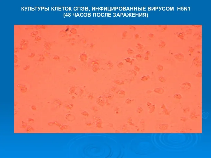 КУЛЬТУРЫ КЛЕТОК СПЭВ, ИНФИЦИРОВАННЫЕ ВИРУСОМ H5N1 (48 ЧАСОВ ПОСЛЕ ЗАРАЖЕНИЯ)