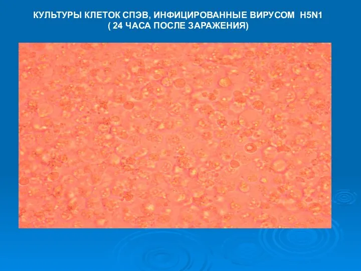 КУЛЬТУРЫ КЛЕТОК СПЭВ, ИНФИЦИРОВАННЫЕ ВИРУСОМ H5N1 ( 24 ЧАСА ПОСЛЕ ЗАРАЖЕНИЯ)