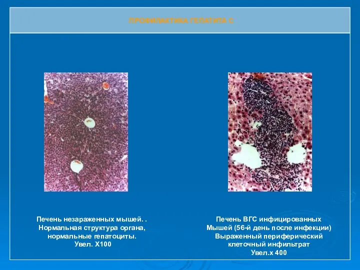 Печень незараженных мышей. . Нормальная структура органа, нормальные гепатоциты. Увел. Х100