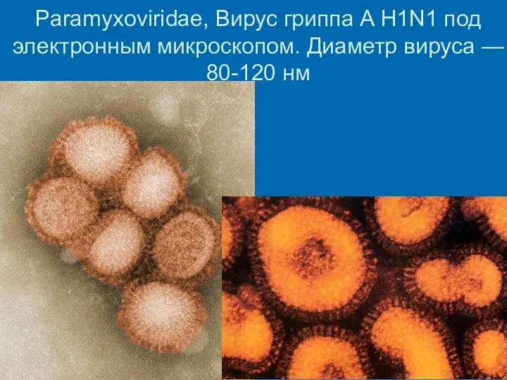 Paramyxoviridae, Вирус гриппа A H1N1 под электронным микроскопом. Диаметр вируса — 80-120 нм