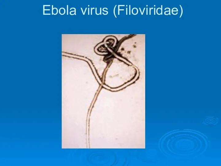 Ebola virus (Filoviridae)