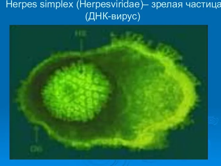 Herpes simplex (Herpesviridae)– зрелая частица (ДНК-вирус)