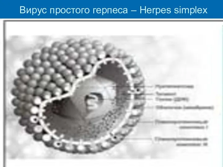 Вирус простого герпеса – Herpes simplex